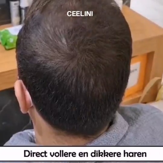 The CEEL haarverdikker spray zorgt voor direct vollere uitstraling die bestendig is tegen regen en transpiratie! #haarverdikkerspray #volumespray #hairfiber #haarvezels #uitgroeispray #haaruitval