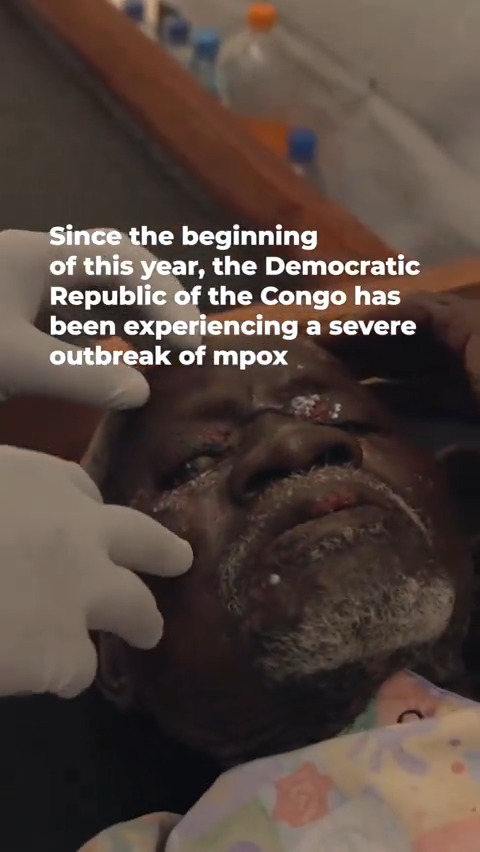 Learn about #mpox and how WHO is working with partners to contain the current mpox outbreak in #DRC.🔽