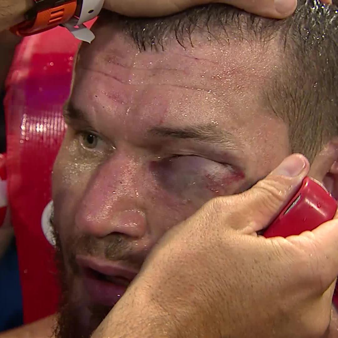 The eye 👀 #MbilliDerevyanchenko | LIVE on ESPN