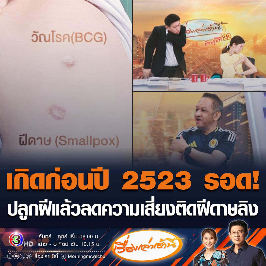 #เรื่องเล่าเช้านี้ หมอศิริราช เผยคนก่อนเกิดปี 2523 จะได้รับการปลูกฝีทุกคน ซึ่งจะมีภูมิต่อต้านฝีดาษลิง คุ้มกันได้นานถึง 92 ปี ทำให้มีความเสี่ยงน้อยลง ส่วนคนที่อายุต่ำกว่า 42 ปี จะไม่มีภูมิ #ข่าวช่อง3 #ข่าวสังคม #ฝีดาษลิง