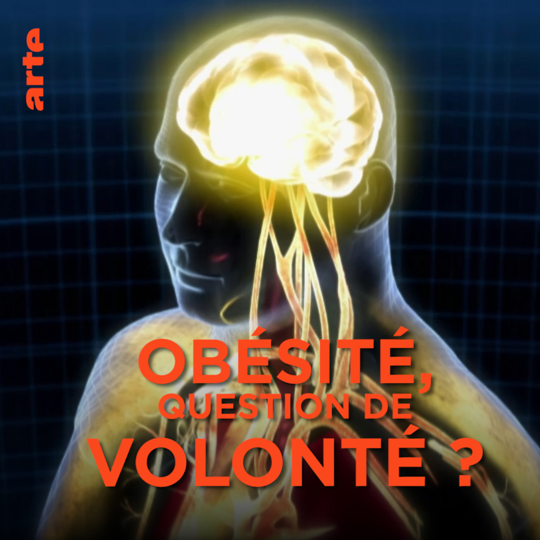 En matière d'obésité, ce sont surtout les clichés qui alimentent le débat ⤵