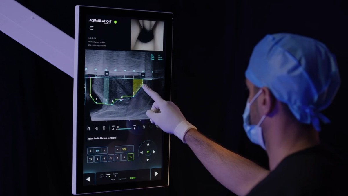 HYDROS™ Robotic System deep dive: FirstAssist AI™, built from a library of real-world Aquablation® therapy procedures, uses advanced image recognition software to identify critical anatomy on ultrasound & suggest optimal treatment plan for each patient