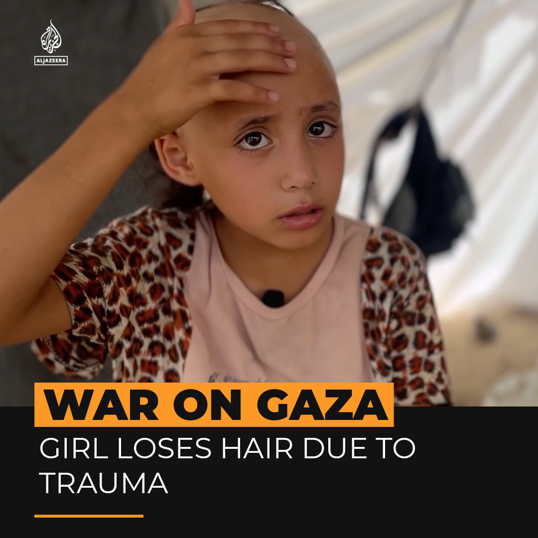 8-year-old Palestinian girl Sama Tabil has lost her hair due to stress and trauma caused by Israel’s war on Gaza. She says she wants to travel to get treatment so she can 'be beautiful again.'