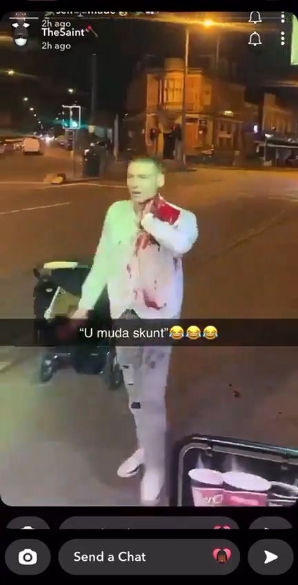@EuropeInvasionn A man, a father stabbed in the neck by the usual suspect, all done in front of his children on a night out. This “multicultural” experiment they have done on Europe and Europeans has been nothing but a failure and it is time we put an end to it!
