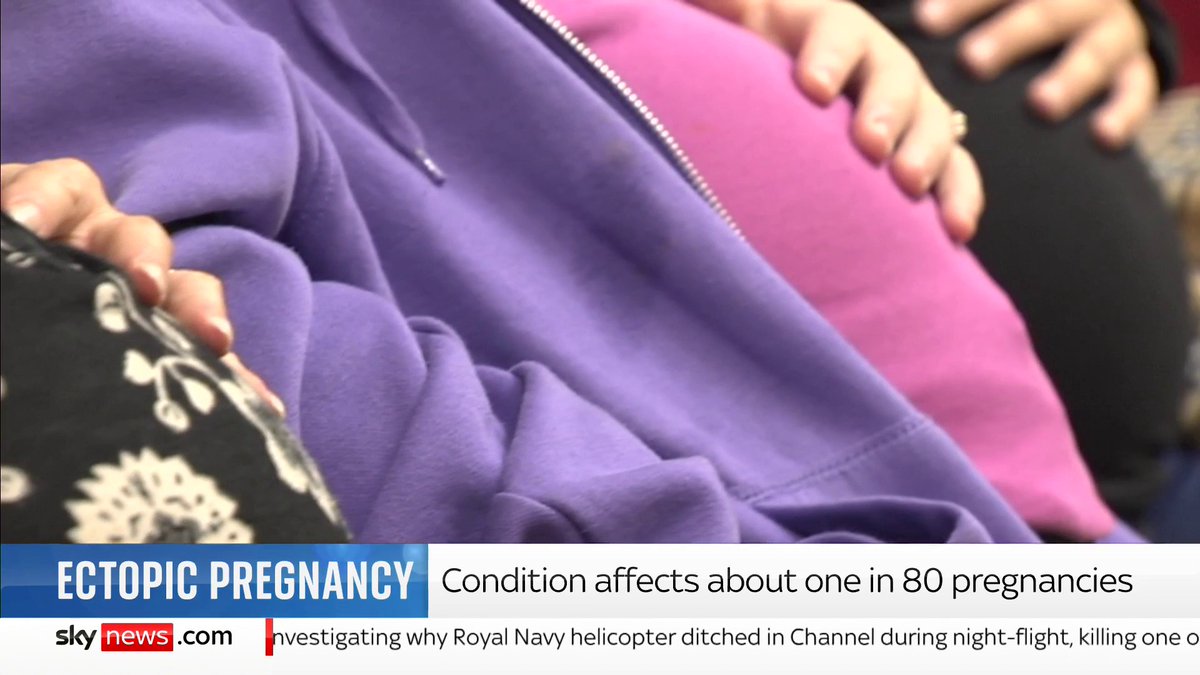 A new drug is being trialled to help treat women with an ectopic pregnancy. Consultant obstetrician at NHS Grampian and chief investigator for the trial, Dr Andrea Woolner, reveals more about the study. 📺 Sky 501, Virgin 602, Freeview 233 and YouTube