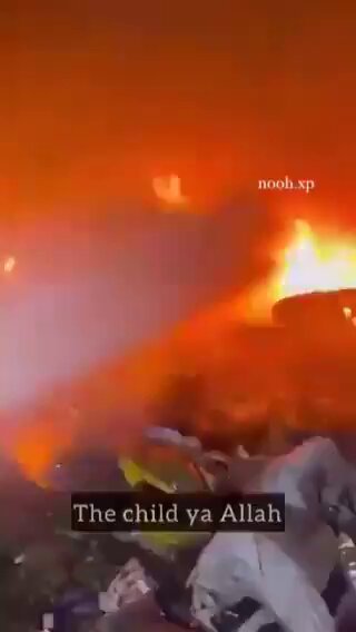 🔴⚡️URGENTE | Las imágenes que nos llegan esta noche desde Gaza son absolutamente aterradoras: decenas de niños palestinos son quemados vivos en un ataque aéreo israelí que tuvo como objetivo una de las escuelas de refugio en Gaza. ❌⚠️Las imágenes son insoportables.