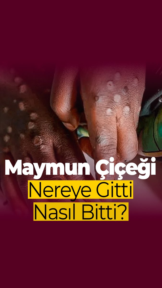 Maymun Çiçeği hastalığı bir gecede nasıl bitti? Nereye gitti bu salgın? →