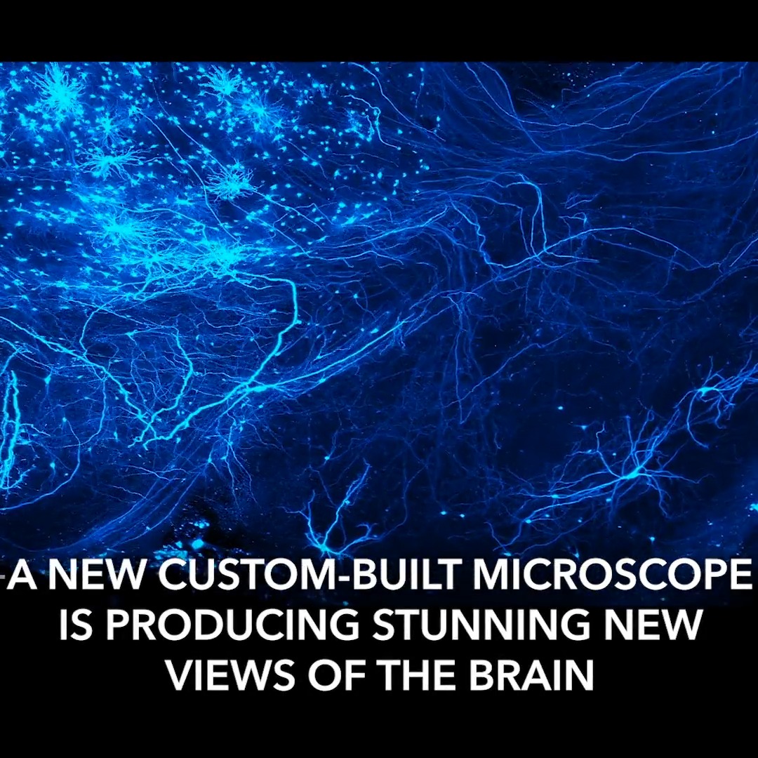 Brain imaging without compromise. ✨🔬 Using technology originally designed for defect detection in electronics manufacturing, the ExA-SPIM microscope is showing scientists the brain as it’s never been seen before. #OpenScienceWeek