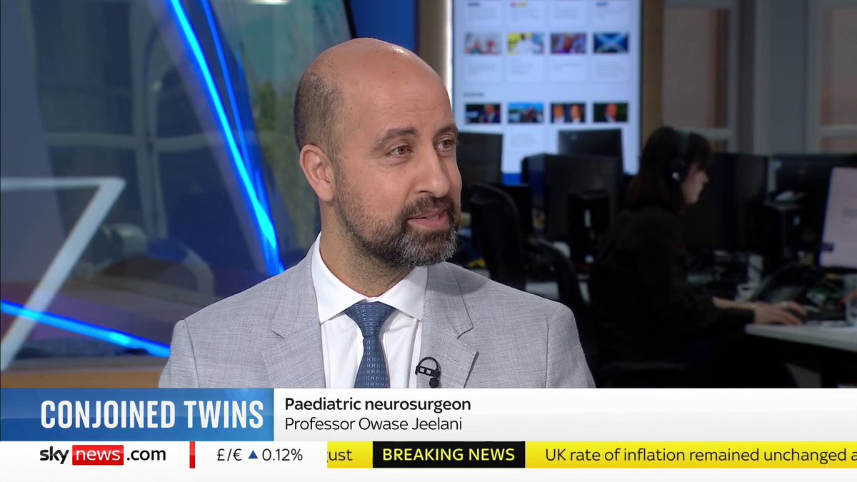 "The odds for both twins have to be good." Paediatric neurosurgeon Professor Owase Jeelani reflects on the ethical challenges of separating conjoined twins after a successful 14-hour surgery. 📺 Sky 501, Virgin 602, Freeview 233 and YouTube
