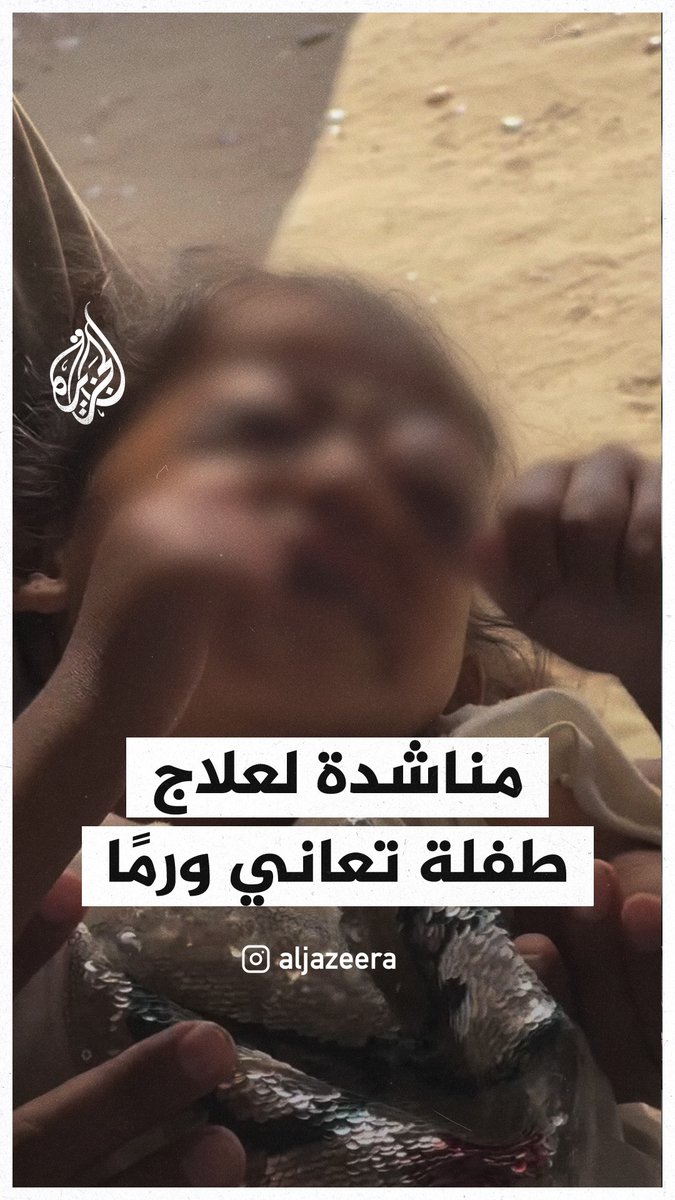 طفلة فلسطينية تعاني من ورم بعينيها وعائلتها تناشد لعلاجها خارج غزة
