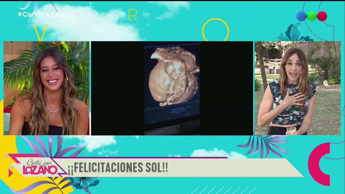 🤰 Sol Pérez contó que está embarazada en #CortaPorLozano