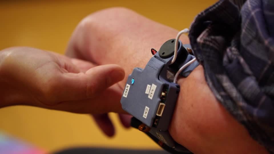 ‘It’s just amazing’: Lisa Vincent’s left arm became immobile following a stroke four years ago. Today, she is one of the first to test Neubond’s wearable rehabilitation device that’s helping her regain the movement she lost