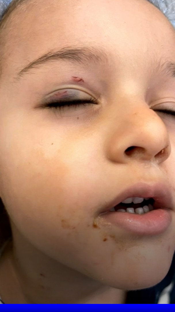 À Cannes, un enfant endormi se fait mordre par un rat en pleine nuit