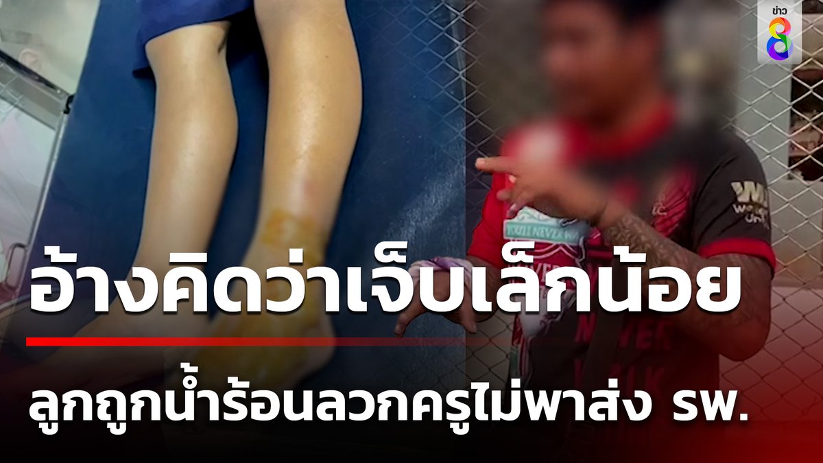ลูกสาว ป.1 ถูกเพื่อนทำน้ำร้อนต้มมาม่า หกใส่เท้าเป็นแผลเหวอะ ครูไม่พาส่งโรงพยาบาล ให้นั่งสอบต่อทาเพียงเบตาดีน ทั้งๆที่เจ็บหนัก #คุยข่าวเช้าช่อง8 #น้ำร้อนลวก #แผลน้ำร้อนลวก #ข่าวช่อง8 #ข่าวช่อง8ที่นี่ของจริง #ข่าวออนไลน์ช่อง8