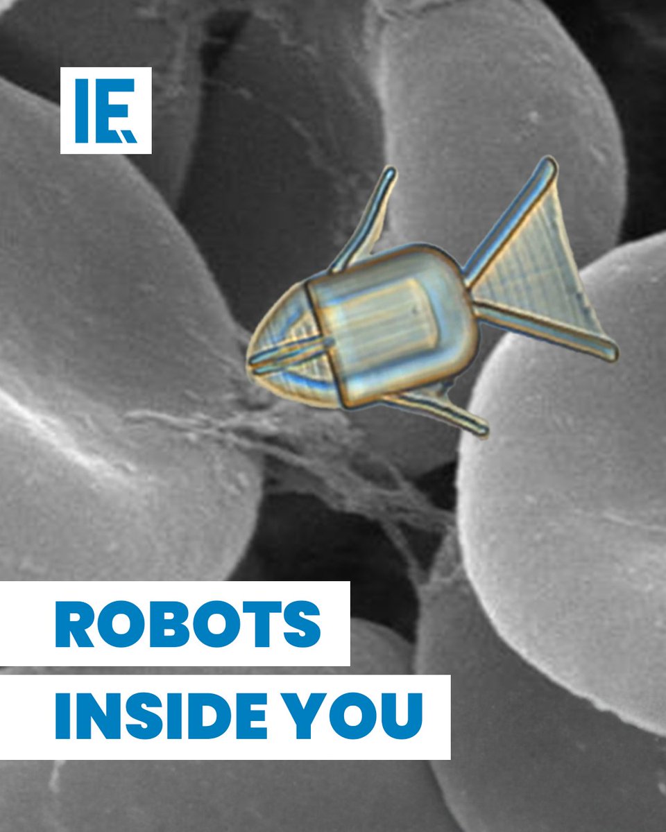 Nanobot: Robot Mini Pembasmi Kanker dari Dalam Tubuh! 🤯 Gmn kalo ada robot mini yg bisa masuk ke dalam tubuh dan basmi kanker langsung ke akarnya? Kenalan sama nanobot, teknologi masa yg bikin kita geleng2 kepala!