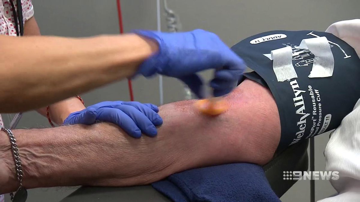 James Harrison donó sangre 1,173 veces a lo largo de 60 años, salvando a millones de bebés con incompatibilidad sanguínea Rh, gracias a un anticuerpo especial en su sangre que ayudó a prevenir la enfermedad hemolítica del recién nacido.