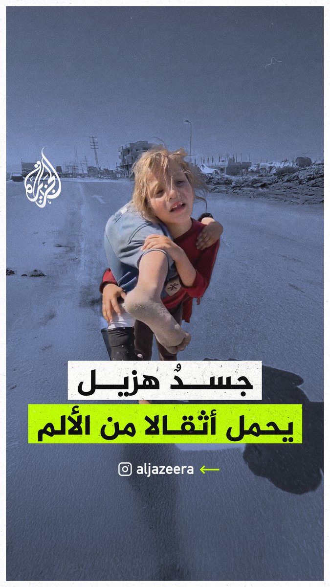 بجسدها الهزيل وعينيها الحزينتين.. طفلة تحمل شقيقتها المصابة أثناء نزوحهما #حرب_غزة