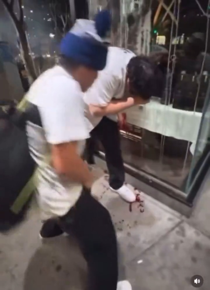 *graphic warning* Los Angeles man out "celebrating" the Dodgers World Series victory holds on to a firecracker a little too long. It ends exactly how you think it will... #CityLife #Dodgers #darwin #california #baseball #WorldSeries #LosAngeles #urban #democrats #OSHA