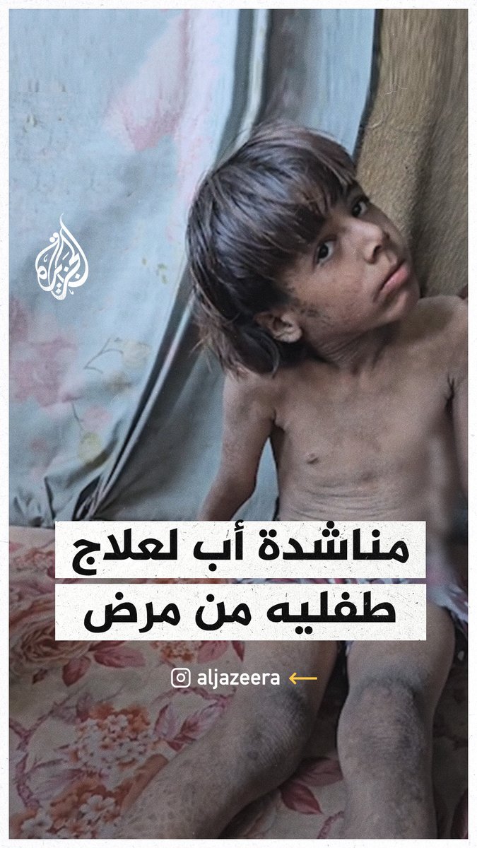 أب في قطاع #غزة يناشد لعلاج طفليه من مرض جلدي مزمن #حرب_غزة