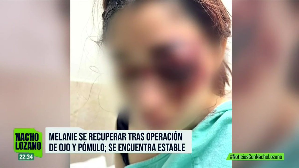 “No se vale que su familia lo esté escondiendo”, la madre de #Melanie pide a las autoridades detener a Christian de Jesús Rojas, el joven que golpeó a su hija en una fiesta en #Tamaulipas. Esto fue lo que nos contó: