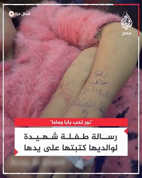 "نور تحب بابا وماما".. استشهاد طفلة جراء نقص الإمكانيات الطبية بعد إصابتها في قصف إسرائيلي شمال قطاع غزة تاركة على يدها رسالة لوالديها