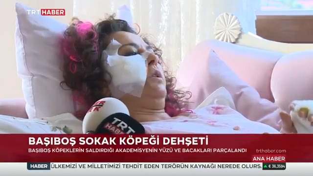 "Bu artık insan hakları sorunu haline geldi" Ankara Çankaya’da yürüyüş yaptığı sırada başıboş sokak köpeklerinin saldırısına uğrayan Prof. Dr. Meliha Yılmaz, yaşadığı korku dolu anları anlattı.