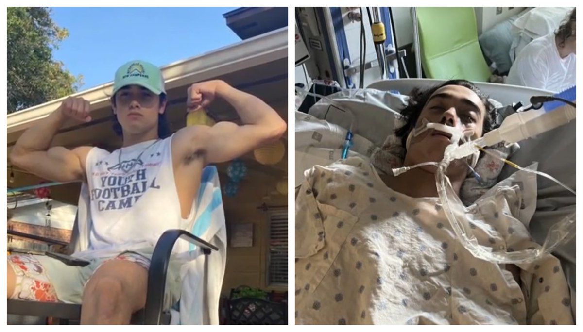 Eight weeks ago, Alesandro was a healthy football player with Churchill High School. Then he's in a hospital fighting for his life from a muscle-eating bacteria.
