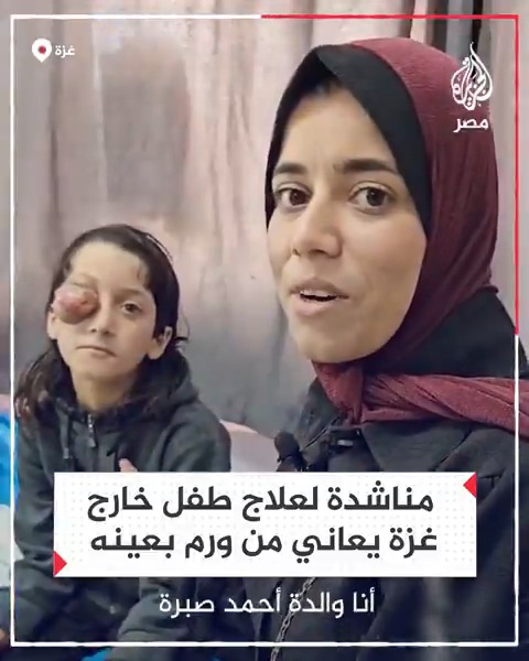 خوفًا من انتقال المرض إلى عينه الأخرى.. طفل فلسطيني مصاب بورم سرطاني في إحدى عينيه يناشد بالسماح له بالسفر خارج غزة لتلقي العلاج