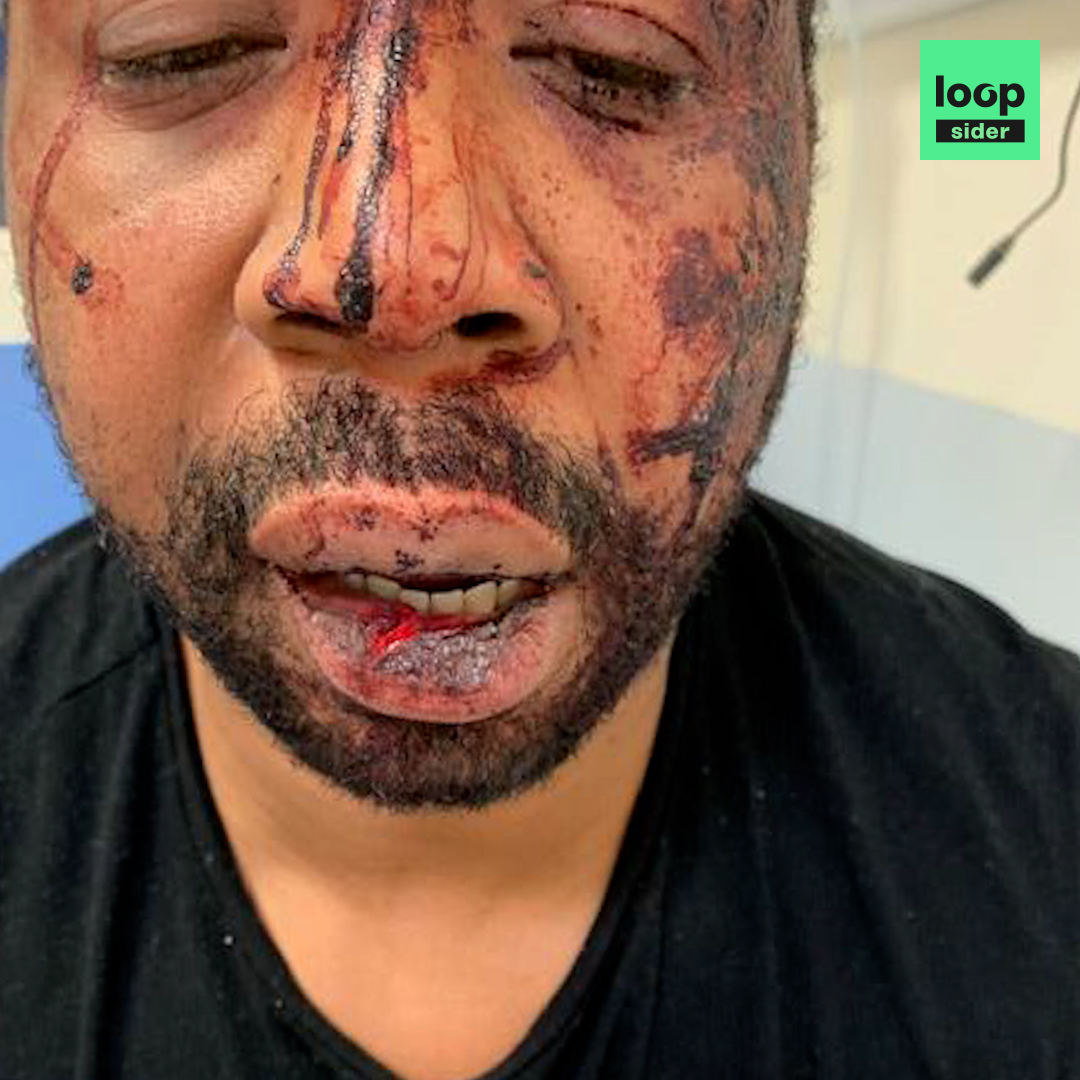 👮♂️« On l’a défoncé, mais le mec il sentait rien c’était ouf ». Quatre ans après l’agression de Michel Zecler, David Perrotin poursuit ses révélations en publiant des messages qui pulvérisent la version des policiers.👇
