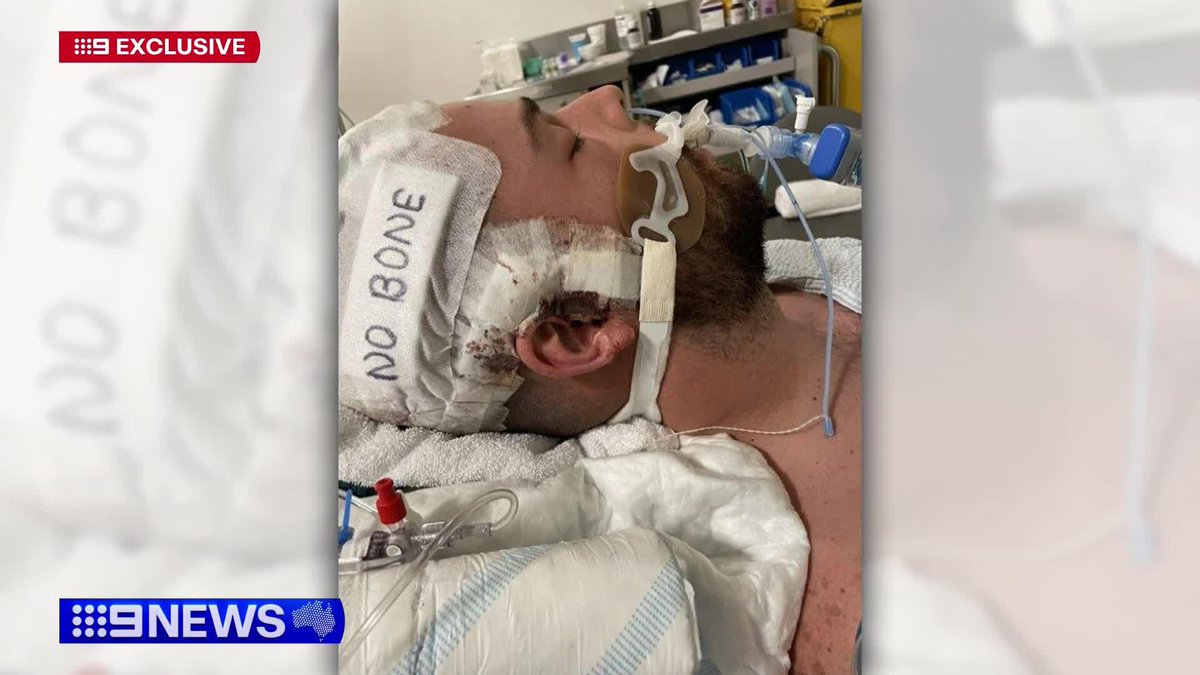 Loved ones of a young man left severely disabled by a coward punch have told Nine News how their lives have been ruined. Izabella Staskowski #9News