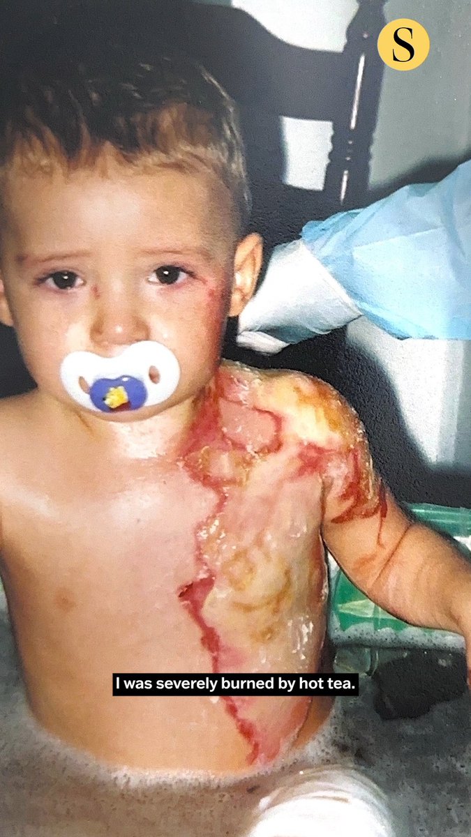 After suffering burns over 60% of his body as a toddler, doctors gave Luca Lutzel little chance of survival. But against all odds, Luca thrived. Now 23, he’s a starting cornerback for the Johns Hopkins football team and a neuroscience major with plans to attend medical school. The accident instilled faith in his parents and in turn, Luca, which he has carried with him to Hopkins. "For the two of us, it has really opened up an opportunity to share our faith, but I think it’s more so for Luca. His faith runs so deep," his father said. Read more: 🎥: Kevin Richardson, The Baltimore Sun