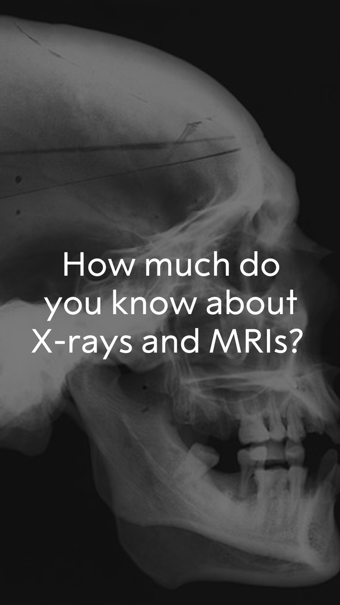 You've likely had an X-ray or MRI, but how much do you know the science and impact of this technology? Before the groundbreaking discovery of X-ray radiation in 1895, the only way to examine the body was through invasive surgical procedures. X-ray images had an immeasurable impact on the medical field and quickly become a powerful tool for physical experiments and examining the body's interior. The next significant development in diagnostic imaging was the introduction of magnetic resonance imaging (MRI), which became widely available in the 1980s. This advanced technology utilises radio waves and a magnetic field in place of radiation. Numerous medical issues within the body can be detected and diagnosed now through these painless tests. Join us for the 2024 Nobel Week Dialogue: The Future of Health on 9 December where we will delve into the critical subject of our health. Nobel Prize laureates and other experts will gather to discuss and envision our future. The topics discussed will range from medical advancements to disease prevention strategies to our environment's impact on our health. Learn more about this event: