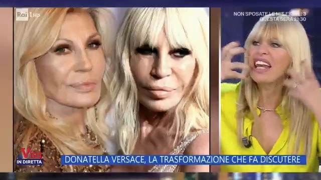 "Donatella Versace prima era tipo un rettile, un lucertolone. No, un serpentello, una cosa felina. Ora ha un viso umanoide" #lavitaindiretta