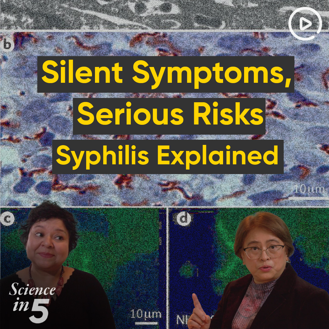 Why are #syphilis cases rising? Who is at risk and how does it spread? Learn about prevention of syphilis from Dr Teodora Elvira Wi in Science in 5.