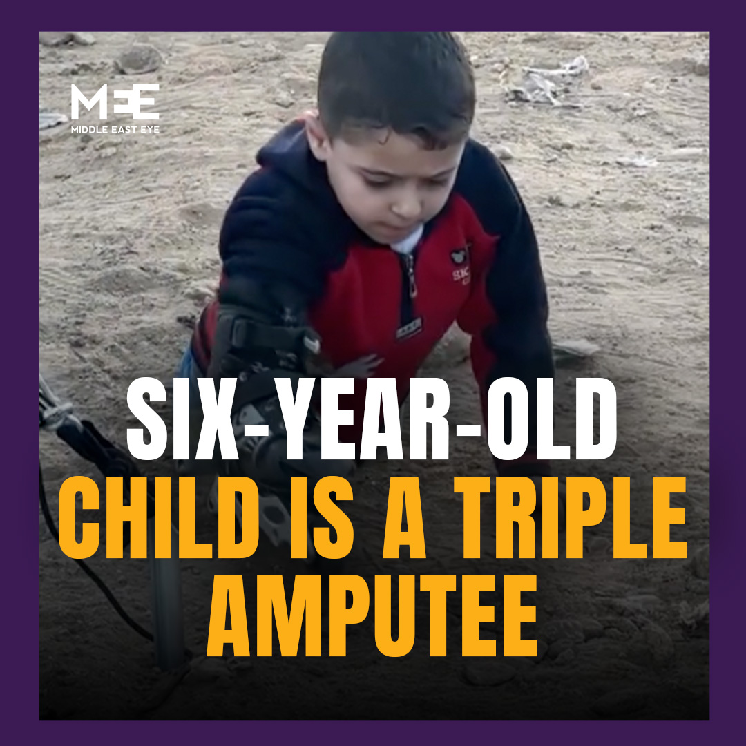 Six-year-old Palestinian child Mohammed Saeed has become a triple amputee as a result of Israel’s attacks. A man walking through the displacement camp was shocked to come across the child, who had lost both legs and an arm, and was using a roller skate to help aid his movement.