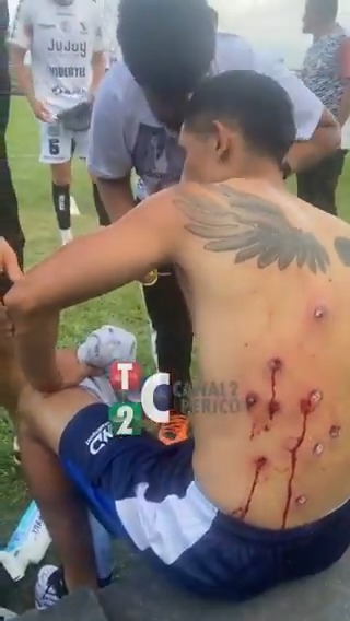 ¡Impactantes imágenes! ❌ Talleres de Perico perdió en Palpalá contra Altos Hornos Zapla en el Regional Federal y quedó eliminado 👎🏻 Sus jugadores ¡fueron reprimidos por la policía! y recibieron balazos de goma 📹 Canal 2 de Perico