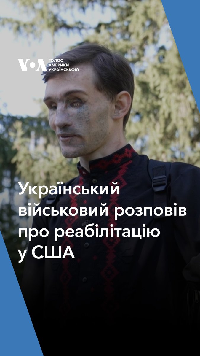 Український військовий Андрій Смоленський на фронті втратив зір, руки, а також частково слух. Зараз він проходить реабілітацію у США.