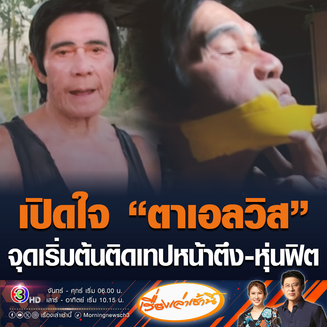 #เรื่องเล่าเช้านี้ "ตาเอลวิส" วัย 78 ปี เผยจุดเริ่มต้นติดเทปกาวดึงหน้า รับมีแพ้บ้าง หน้าถลอกเป็นแผล แต่พอหายก็กลับมาติดใหม่ เตือนอย่าทำตาม แนะใช้เทปทางการแพทย์ดีกว่า ส่วนหุ่นฟิตเปรี๊ยะเพราะออกกำลังกายทุกวัน #ข่าวช่อง3 #ข่าวโซเชียล #ตาเอลวิส