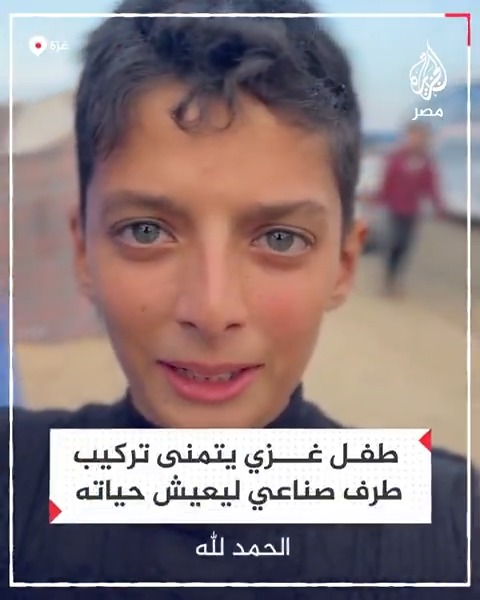 طفل غزي يتمنى تركيب طرف صناعي ليعيش حياته كغيره من الأطفال بعد إصابته في قصف للاحتلال على القطاع