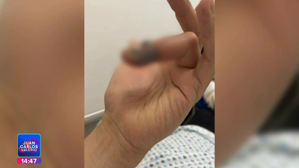 #Indignante || Un hombre tuvo que gastar más de 90 mil pesos en un hospital privado debido a que le fue negado un antídoto de picadura de araña en el Hospital General del Sur. #NoticiasPuebla #Puebla #JuanCarlosValerioNoticias