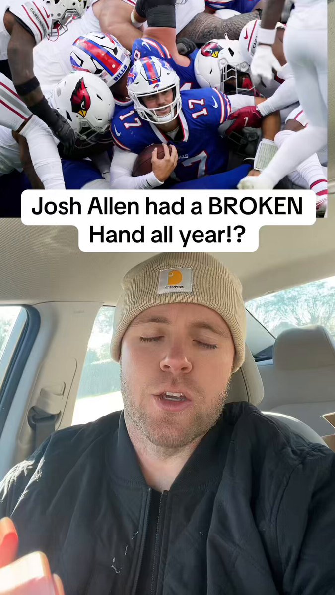 It’s official. Josh Allen’s hand really was broken #billsmafia