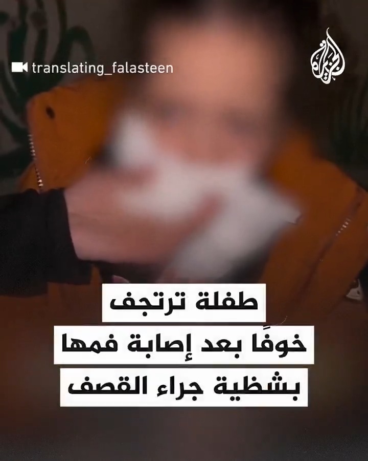 طفلة ترتجف خوفا بعد إصابة فمها بشظية جراء القصف على غزة #حرب_غزة