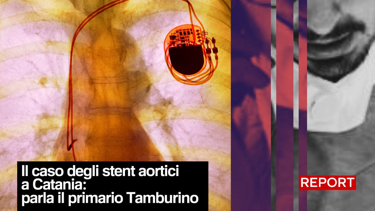 Il professore Corrado Tamburino è considerato il re della cardiologia italiana, insieme ad altri primari e manager di aziende biomedicali. Segui #Report ora in diretta su #Rai3👇