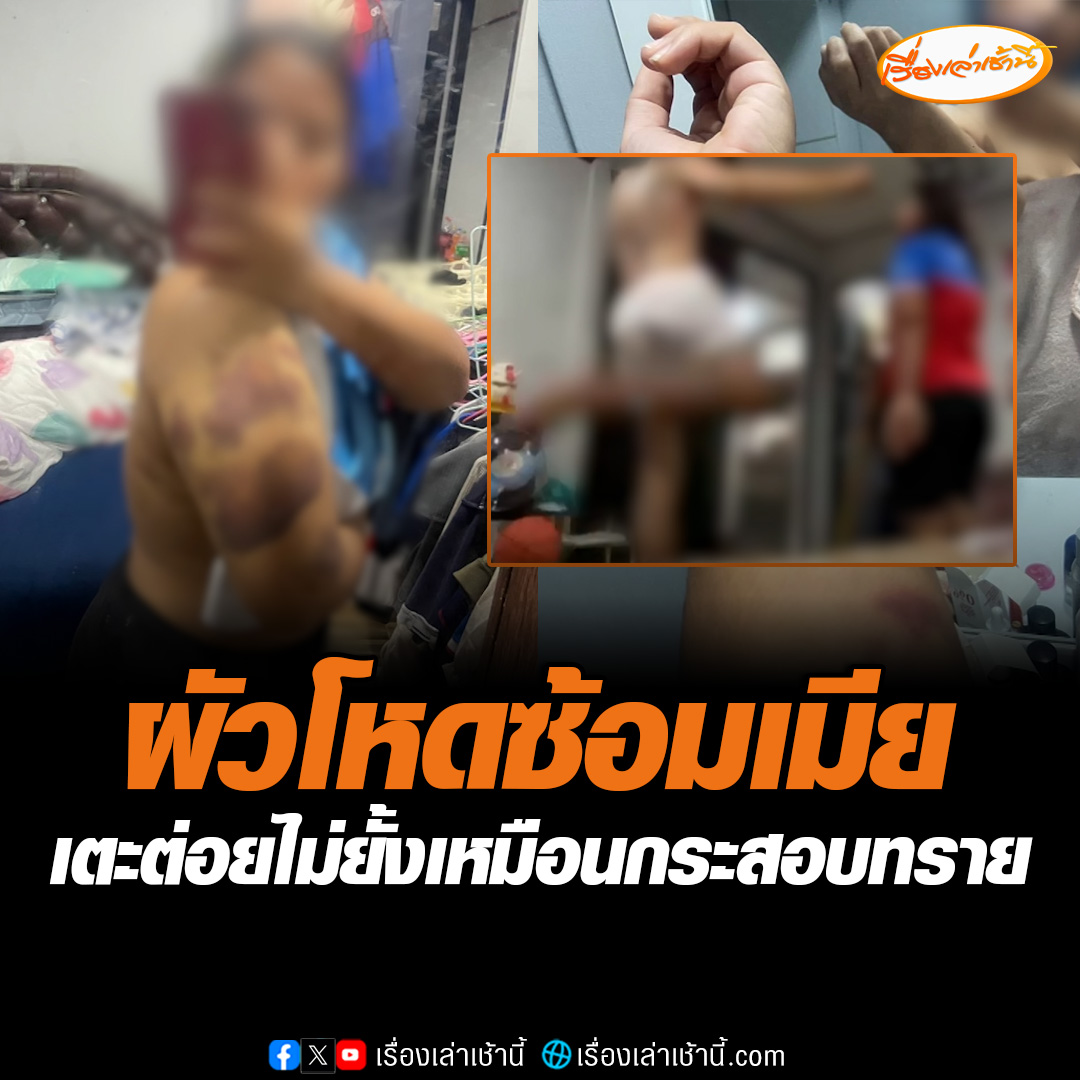 เมียสุดทน โพสต์ถูกสามีใช้กำลังทำร้ายร่างกาย อย่างรุนแรง ล่าสุดเมียเข้าแจ้งความที่ สภ.เมืองชุมพรแล้ว ยืนยันดำเนินคดีให้ถึงที่สุด #เรื่องเล่าเช้านี้ #ข่าวช่อง3 #ข่าวสังคม
