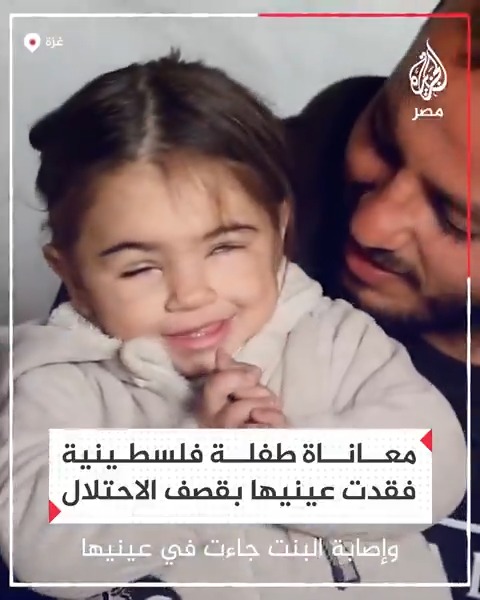نزوح وإصابة وفقدان بصر.. أب فلسطيني موجوع على طفلته التي أصيبت عينها في قصف إسرائيلي يناشد لإتاحة فرصة لعلاجها خارج قطاع #غزة