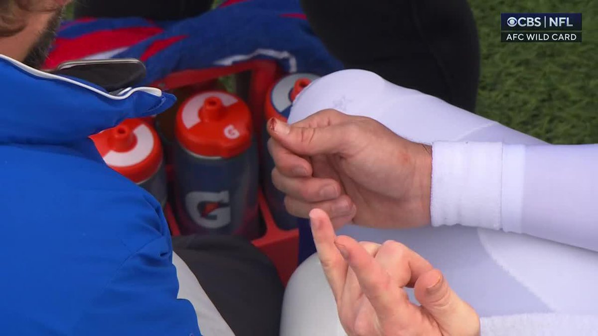 Dawg: Josh Allen had to RIP his nail off. No one is as tough as Allen in the NFL. 😤😤😤