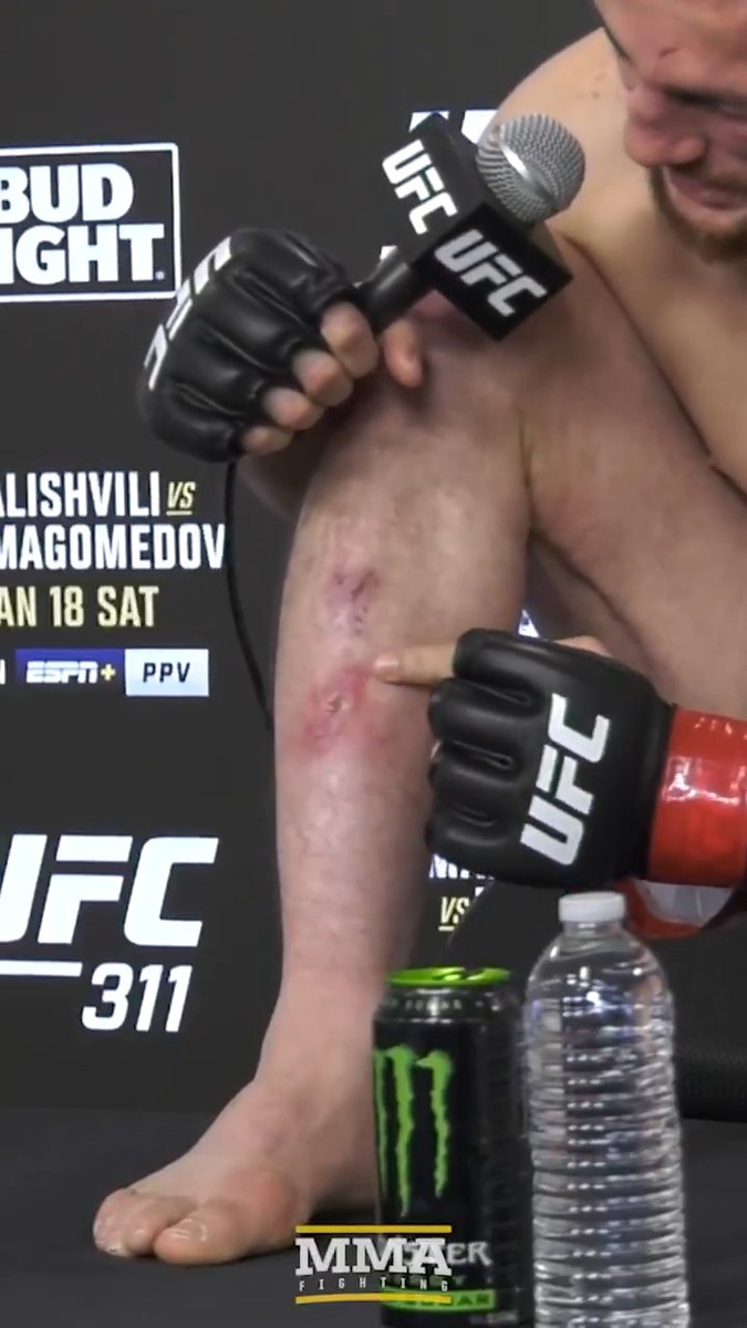 Merab Dvalishvili shows off the injuries he was dealing with heading into #UFC311: "In November I got big cuts on my leg. … It was taking so long to heal up and then it got infected."