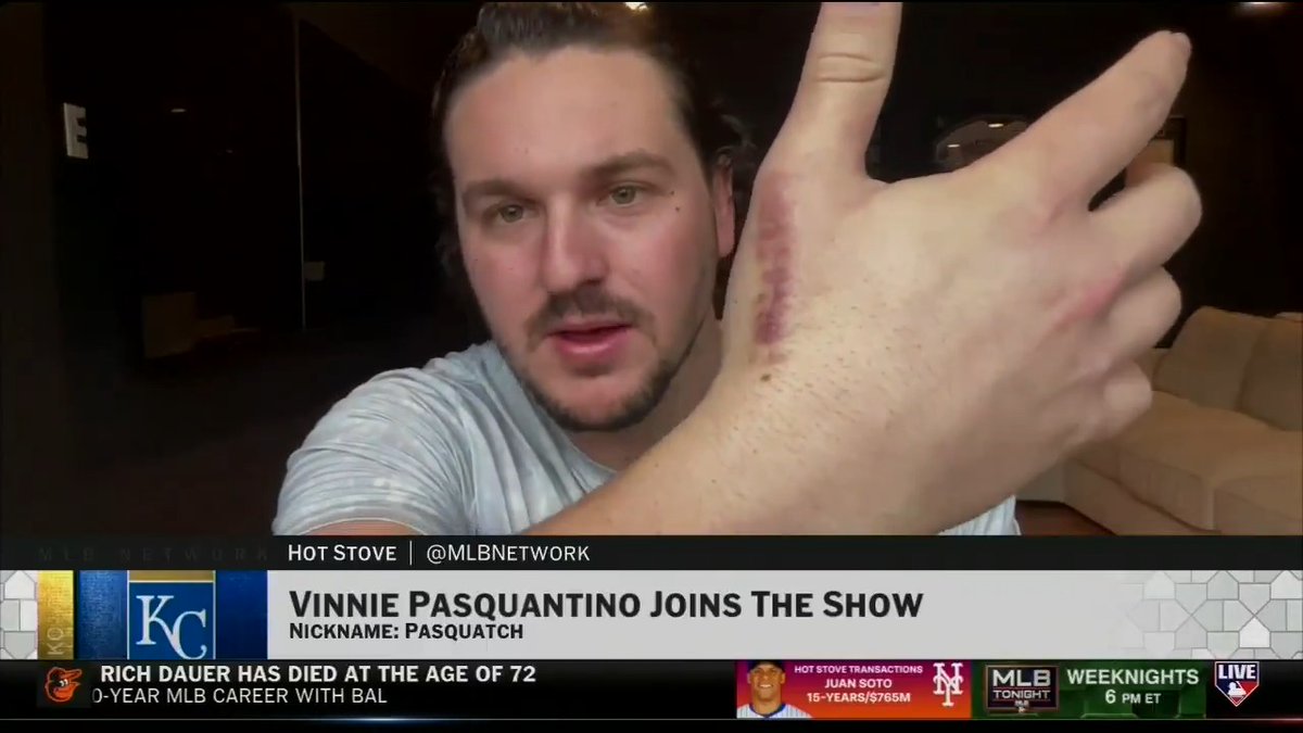 .Vinnie Pasquantino is fully healthy and ready to head to Spring Training for his 4th Big League season! The Kansas City Royals slugger joined us on #MLBNHotStove to talk through his Postseason return from injury last season and much more.