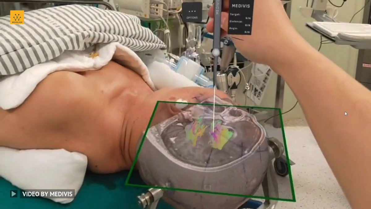 Medivis’ technology transforms complex 2D imaging, like MRI and CT scans, into real-time 3D visualizations that can be superimposed onto the patient's body in real-time at the bedside. Video Credit: @Medivis_AR #engineering #technology #hologram #augmentedreality