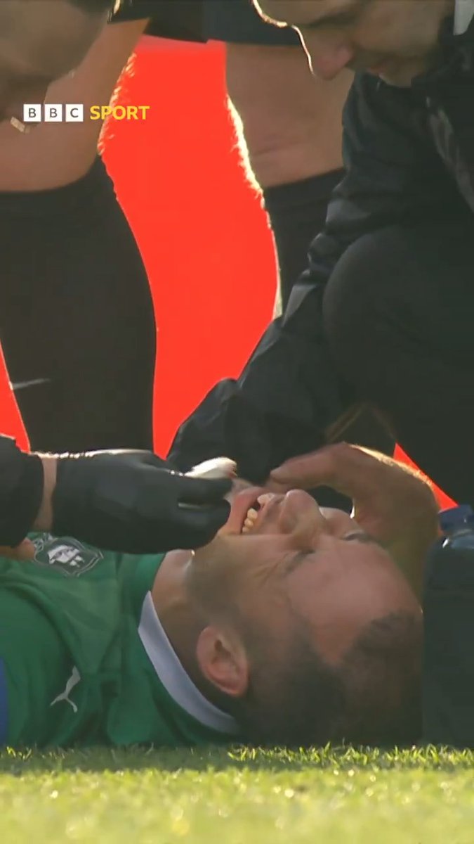 OUCH! Plymouth Argyle definitely weren't toothless against Liverpool... but Nikola Katic literally was! 😬 #FACup
